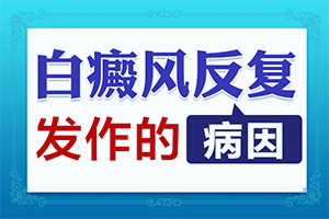 手指关节白殿用外用药膏好一些