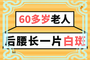 为什么白点癫风长时间的治疗不见好