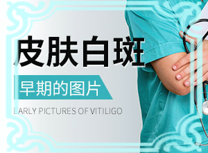 男性生殖器表皮有白殿痒怎么办