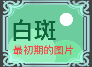 小孩胳膊上有白颠摸了药没那么白啦是不是快好啦