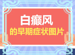 治疗肢端型白点癫风的方法都有什么