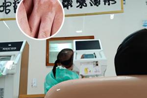 308紫外线怎样照效果好