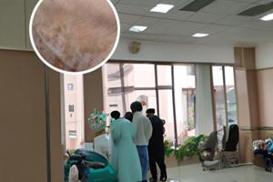 兰州中研311光疗有效吗