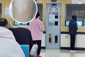 兰州治疗白斑费用多少
