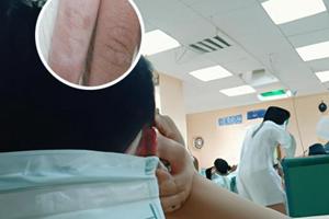 兰州白斑专科医院排名