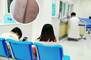 复方孜然酊治白斑有用吗