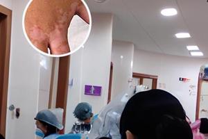 白癜风光疗仪器危害分析