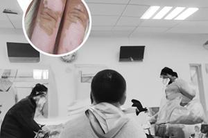 复方倍他米松注射治疗什么的