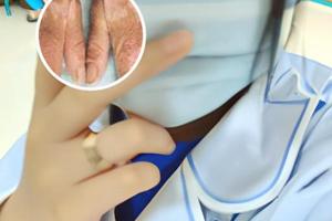 倍他米松片用法用量