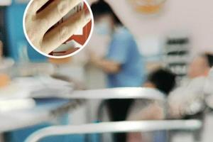 点阵激光按部位很贵