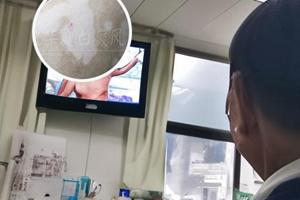 光疗的价格影响因素包括