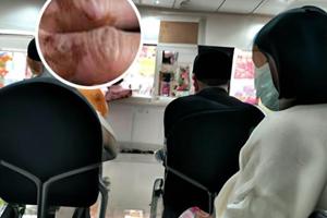 阿法诺肽能彻底治愈白斑吗图片吗