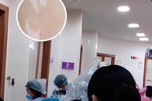 兰州白斑医院哪家好排行榜