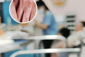 倍他米松片多少钱一盒