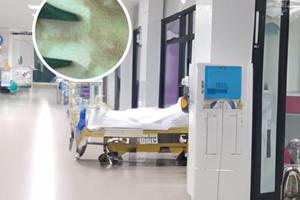 兰州中研白癜风医院病友点评