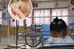 兰州中研医院治疗白癜风效果好吗