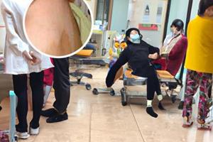 兰州中研医院是正规医院吗多少钱一次