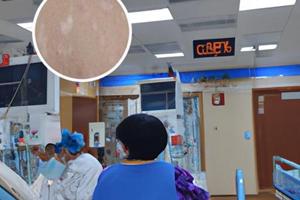 兰州中研白癜风医院如何走