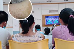 甘肃哪里有治疗白斑的医院啊