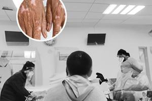 兰州中研白斑病医院地址