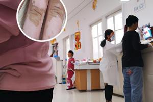 兰州中研医院308怎么收费