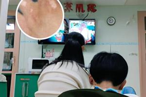 卤米松乳膏和派瑞松哪个好