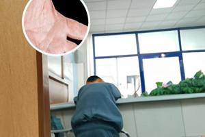 外阴白斑兰州哪家医院治疗好