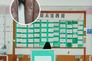 兰州中研杨红红主任预约挂号
