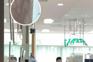 阿法诺肽植入剂上市了吗是真的吗为什么呢啊