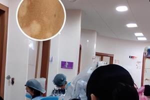 兰州中研白斑治疗医院