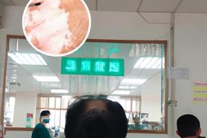 兰州中研白斑收费标准公证