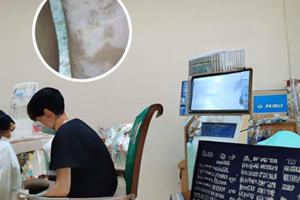 好评兰州中研白癜风最新治疗方法