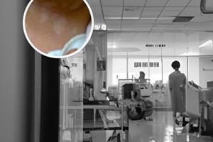 兰州白癜风医院有几家