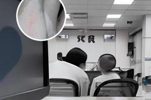兰州中研白斑咋样