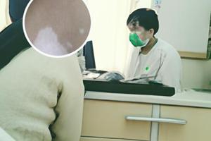 兰州中研白癜风医院有多少人被治疗好了
