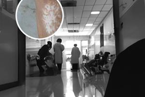 兰州中研白癫风医院公交