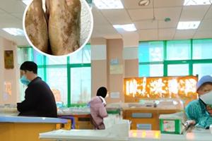 兰州中研医院杨红红专家门诊