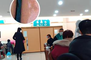 兰州中研白癜风医院路线