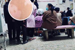 兰州中研白癜风医院侯慧永医生