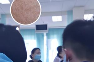 兰州中研白癜风专科医院在什么地方