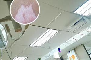 兰州中研治白斑医院怎么样