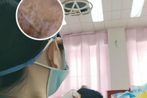 复方倍他米松注射怎么使用