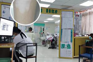 复方甘草酸苷片需要服用多久