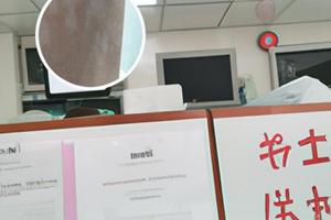 滚针多少钱一次手工