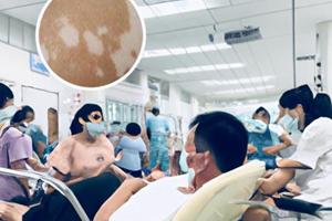百多邦药膏是管什么的