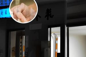 伍德灯可以确诊吗为什么