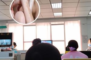 卤米松乳膏治什么的
