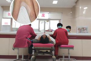 阿法诺肽什么时候上市了