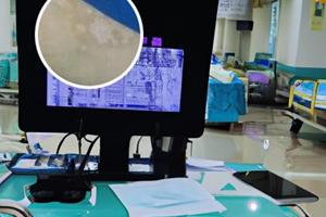 白癜风光疗仪308一次需要照多久