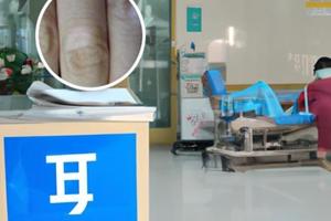 阿法诺肽研制视频最新